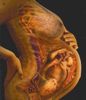 pregnantmother.jpg